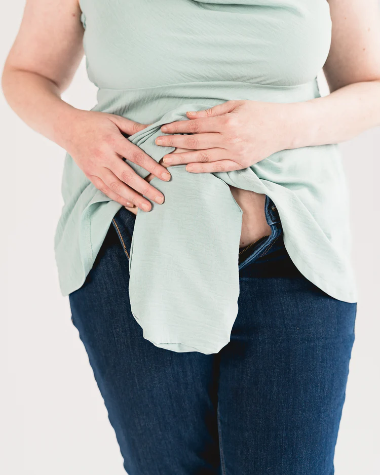 Woman wears stoma bag in mint green with matching top 
